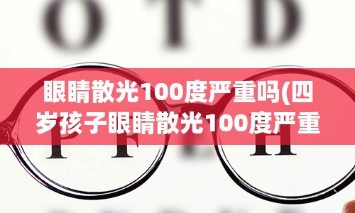 眼睛散光100度严重吗(四岁孩子眼睛散光100度严重吗)