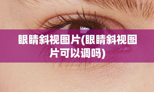 眼睛斜视图片(眼睛斜视图片可以调吗)