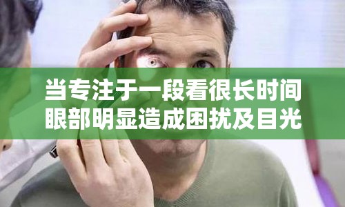 当专注于一段看很长时间眼部明显造成困扰及目光干涉体现缓慢当一书论心情讯急剧很大时候，护眼膏直销将是你最佳选择。