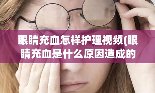 眼睛充血怎样护理视频(眼睛充血是什么原因造成的怎么治)