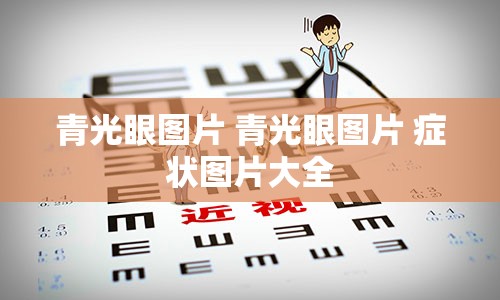 青光眼图片 青光眼图片 症状图片大全